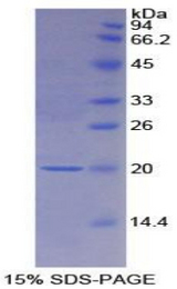 CSF1R / CD115 / FMS Protein - Recombinant Colony Stimulating Factor Receptor, Macrophage By SDS-PAGE