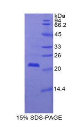 CSF3R / CD114 Protein