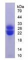 CSF3R / CD114 Protein - Recombinant Colony Stimulating Factor Receptor, Granulocyte By SDS-PAGE