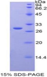CST / GAL3ST1 Protein - Recombinant Galactose-3-O-Sulfotransferase 1 By SDS-PAGE