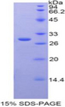 CST / GAL3ST1 Protein - Recombinant Galactose-3-O-Sulfotransferase 1 By SDS-PAGE