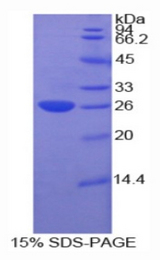 CTF1 / Cardiotrophin-1 Protein - Recombinant Cardiotrophin 1 By SDS-PAGE