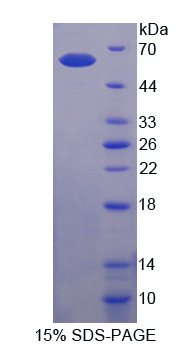 CTH / Cystathionase Protein - Recombinant  Cystathionine Gamma Lyase By SDS-PAGE