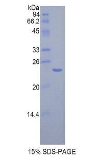 CTSB / Cathepsin B Protein - Recombinant Cathepsin B By SDS-PAGE