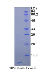 CTSD / Cathepsin D Protein - Recombinant Cathepsin D By SDS-PAGE