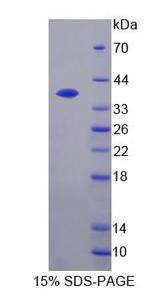 CXCL11 Protein - Recombinant  Interferon Inducible T-Cell Alpha Chemoattractant By SDS-PAGE