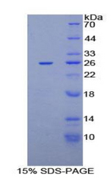 CXCL16 Protein - Recombinant Chemokine C-X-C-Motif Ligand 16 By SDS-PAGE