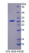 CYGB / Cytoglobin Protein - Recombinant Cytoglobin By SDS-PAGE