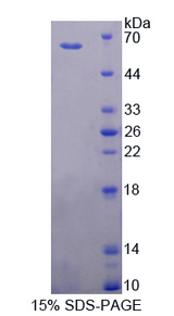 CYP11B1 Protein - Recombinant  Cytochrome P450 11B1 By SDS-PAGE