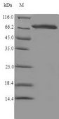 CYP17 / CYP17A1 Protein - (Tris-Glycine gel) Discontinuous SDS-PAGE (reduced) with 5% enrichment gel and 15% separation gel.