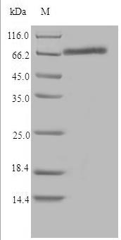 CYP1B1 Protein - (Tris-Glycine gel) Discontinuous SDS-PAGE (reduced) with 5% enrichment gel and 15% separation gel.