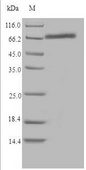 CYP1B1 Protein - (Tris-Glycine gel) Discontinuous SDS-PAGE (reduced) with 5% enrichment gel and 15% separation gel.