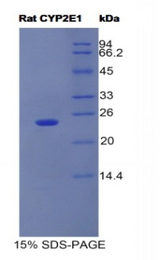 CYP2E1 Protein - Recombinant Cytochrome P450 2E1 By SDS-PAGE