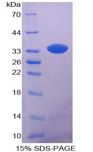 CYP7A1 Protein - Recombinant Cytochrome P450 7A1 By SDS-PAGE
