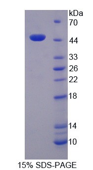 CYPOR / POR Protein - Recombinant Cytochrome P450 Reductase By SDS-PAGE