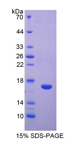 DAB1 Protein - Recombinant  Disabled Homolog 1 By SDS-PAGE