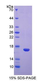 DAB1 Protein - Recombinant  Disabled Homolog 1 By SDS-PAGE