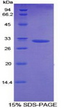 DGKA Protein - Recombinant Diacylglycerol Kinase Alpha By SDS-PAGE