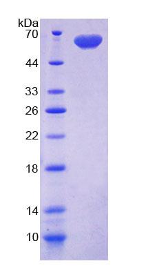 DIO2 Protein - Recombinant Deiodinase, Iodothyronine, Type II By SDS-PAGE