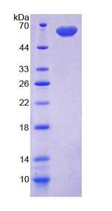 DIO2 Protein - Recombinant Deiodinase, Iodothyronine, Type II By SDS-PAGE