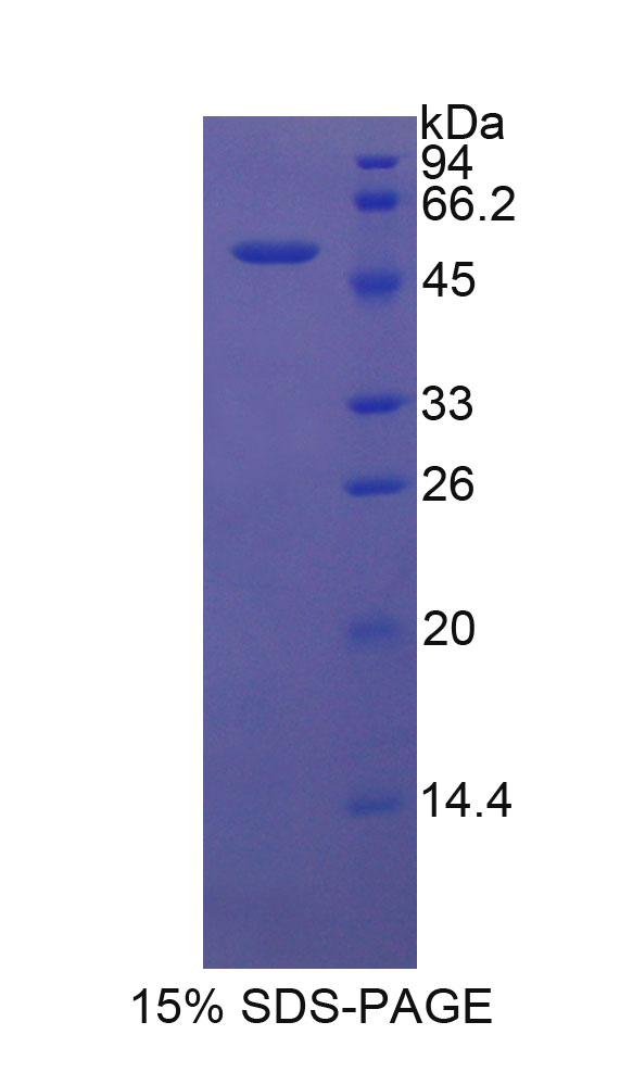 DKK1 Protein - Recombinant Dickkopf Related Protein 1 By SDS-PAGE