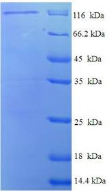 DLG3 / SAP102 Protein
