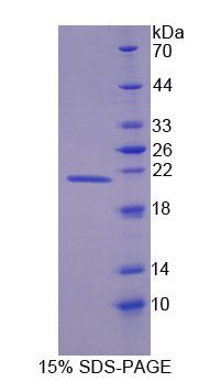 DMPK / DM Protein - Recombinant Dystrophia Myotonica Protein Kinase (DMPK) by SDS-PAGE