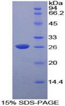 DNASE1L2 Protein - Recombinant Deoxyribonuclease I Like Protein 2 By SDS-PAGE
