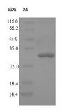 DPP4 / CD26 Protein - (Tris-Glycine gel) Discontinuous SDS-PAGE (reduced) with 5% enrichment gel and 15% separation gel.