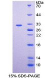 ECE-1 Protein - Recombinant Endothelin Converting Enzyme 1 By SDS-PAGE