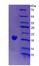 EDN1 / Endothelin 1 Protein - Recombinant Endothelin 1 By SDS-PAGE