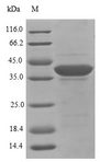 EIF3I / EIF3S2 Protein - (Tris-Glycine gel) Discontinuous SDS-PAGE (reduced) with 5% enrichment gel and 15% separation gel.