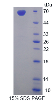 EMA / MUC1 Protein - Recombinant  Mucin 1 By SDS-PAGE