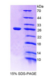 EMILIN1 / EMI Protein - Recombinant Elastin Microfibril Interface Located Protein 1 By SDS-PAGE