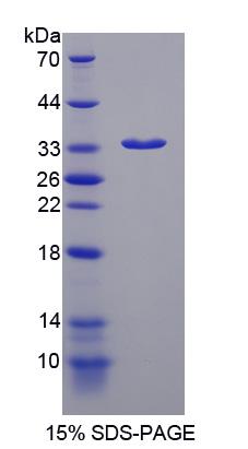 EML2 / EMAP2 Protein - Recombinant Echinoderm Microtubule Associated Protein Like Protein 2 By SDS-PAGE
