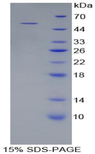 Endostatin Protein - Recombinant Collagen Type XVIII By SDS-PAGE