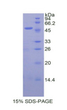 Endostatin Protein - Recombinant Endostatin (ES) by SDS-PAGE