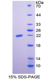 EPO / Erythropoietin Protein - Recombinant Erythropoietin By SDS-PAGE