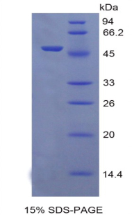 ERBB2 / HER2 Protein - Recombinant Epidermal Growth Factor Receptor 2 By SDS-PAGE