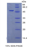 ERBB2 / HER2 Protein - Recombinant Epidermal Growth Factor Receptor 2 By SDS-PAGE