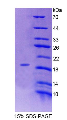 ERP29 Protein - Recombinant Endoplasmic Reticulum Protein 29 By SDS-PAGE
