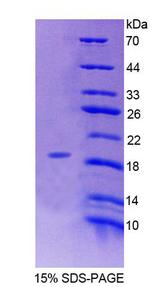 ERP29 Protein - Recombinant Endoplasmic Reticulum Protein 29 By SDS-PAGE