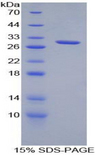 ESAM Protein - Recombinant Endothelial Cell Adhesion Molecule By SDS-PAGE