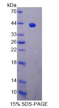 EXOC3 / SEC6 Protein - Recombinant Exocyst Complex Component 3 (EXOC3) by SDS-PAGE