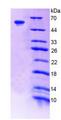 F11 / FXI / Factor XI Protein - Recombinant Coagulation Factor XI By SDS-PAGE