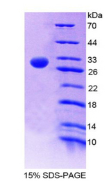 F13A1 / Factor XIIIa Protein - Recombinant  Coagulation Factor XIII A1 Polypeptide By SDS-PAGE