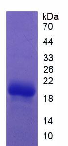 F2 / Prothrombin / Thrombin Protein - Active Coagulation Factor II (F2) by SDS-PAGE