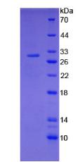 F3 / CD142 / Tissue factor Protein - Active Tissue Factor (TF) by SDS-PAGE