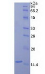 F7 / Factor VII Protein - Recombinant Coagulation Factor VII By SDS-PAGE