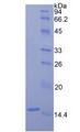 F7 / Factor VII Protein - Active Coagulation Factor VII (F7) by SDS-PAGE